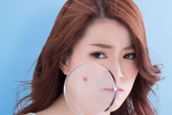 5 Best Korean Skincare Products For Acne-Prone Skin