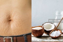 Do You Want To Get Rid Of Your Stretch marks And Achieve A Flawless Skin Like Your Favorite Korean Actress? Here’s How!